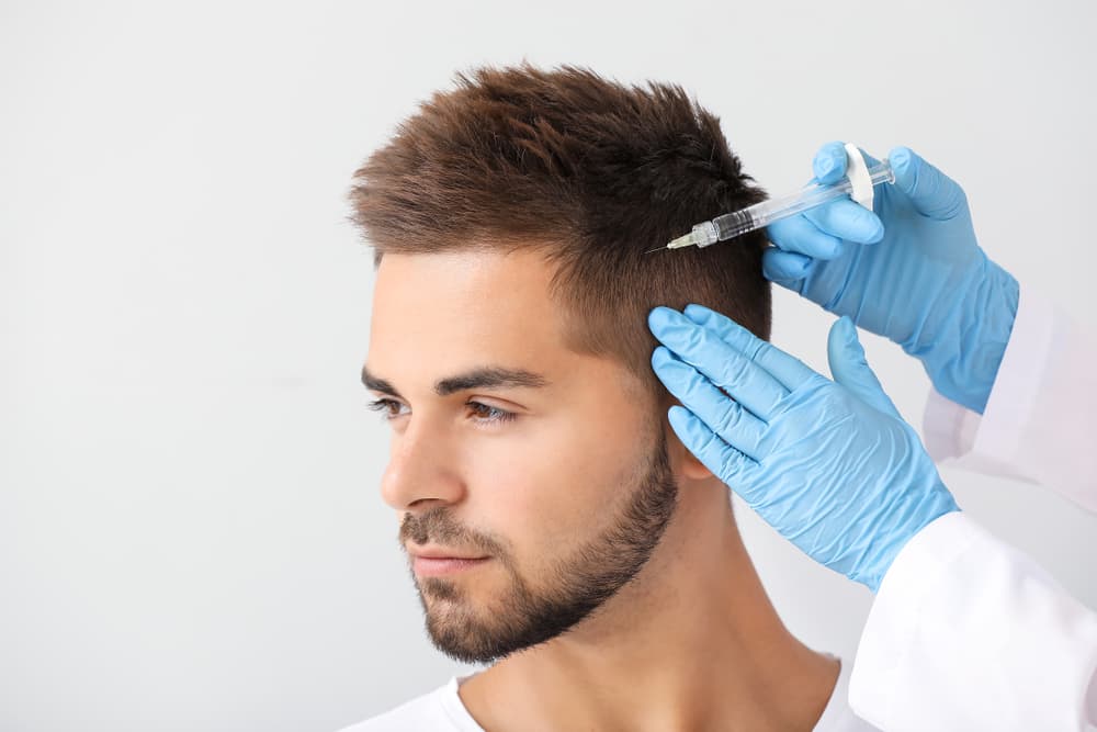 How to Manage Hair Loss with Acupuncture