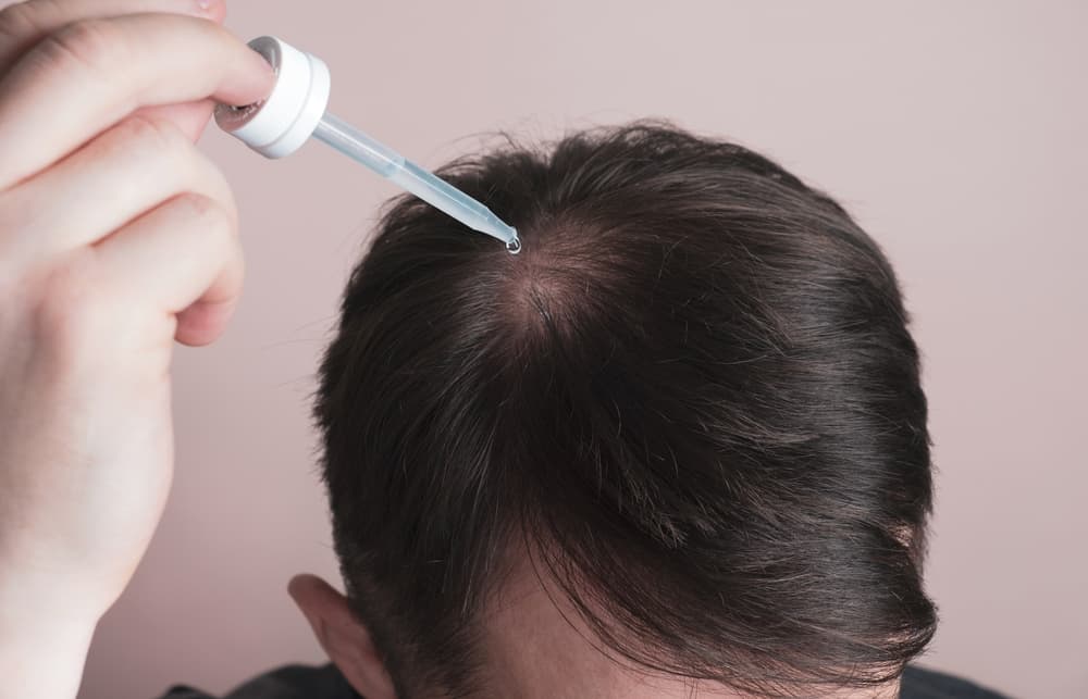 How to Use Scalp Micropigmentation for Hair Loss