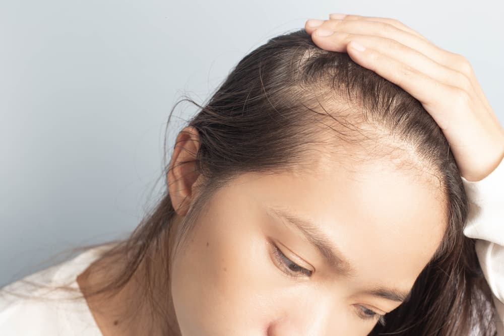 Understanding the Connection Between Thyroid Issues and Hair Loss