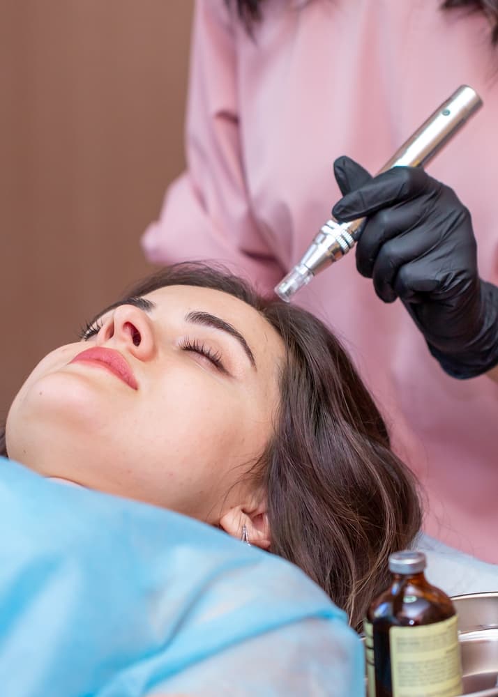 Step-by-Step Guide to Microneedling for Hair Loss