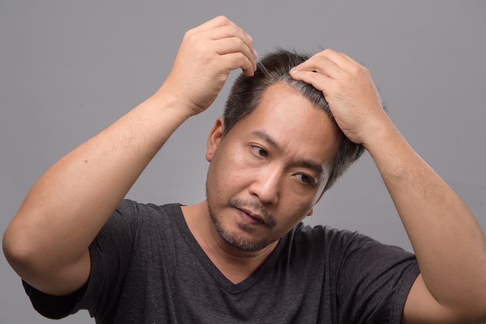 The Impact of Age on Hair Loss: What You Need to Know