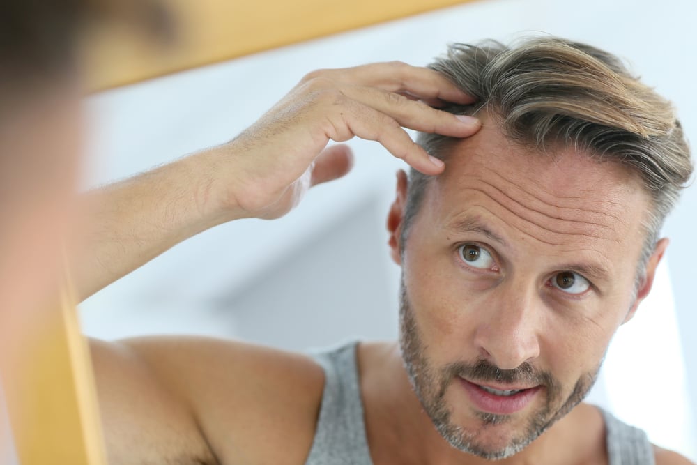 Managing Hair Loss in Menopause: A Comprehensive Guide