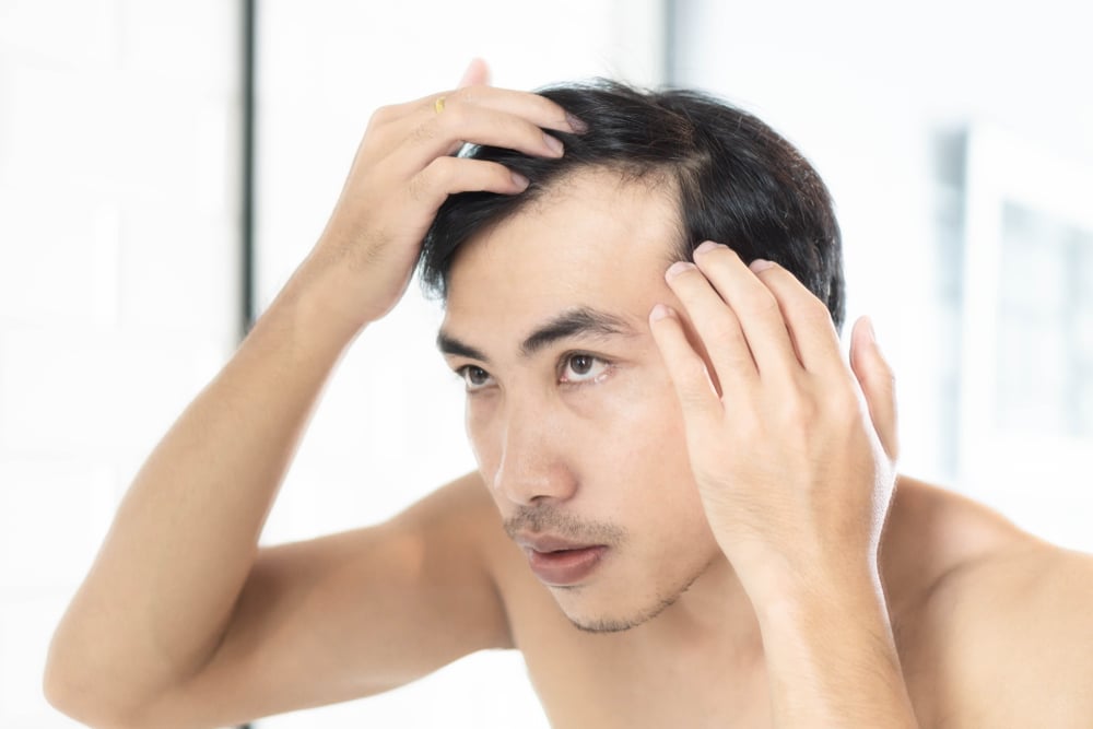 How to Create a Hair Loss Treatment Plan for Men