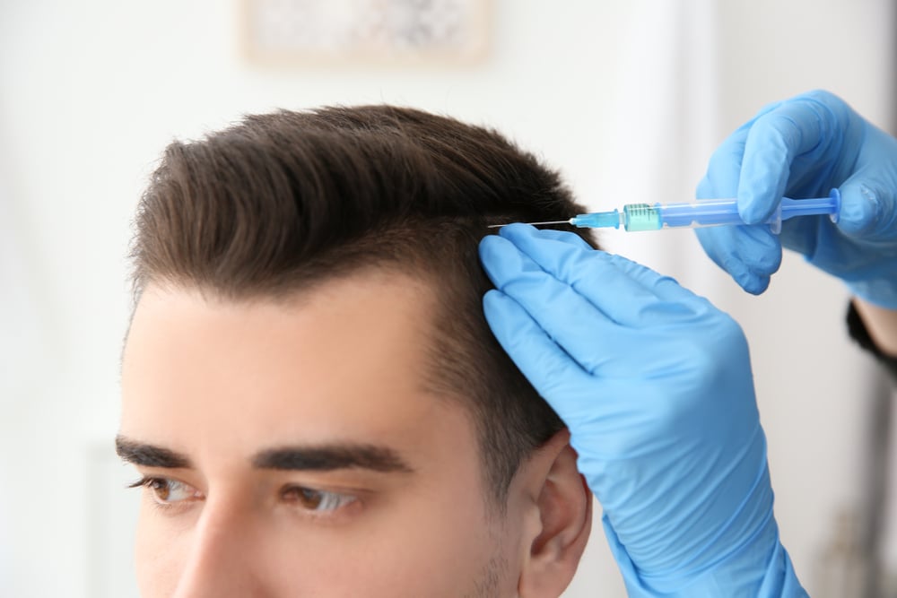 How to Choose the Right Hair Transplantation Method