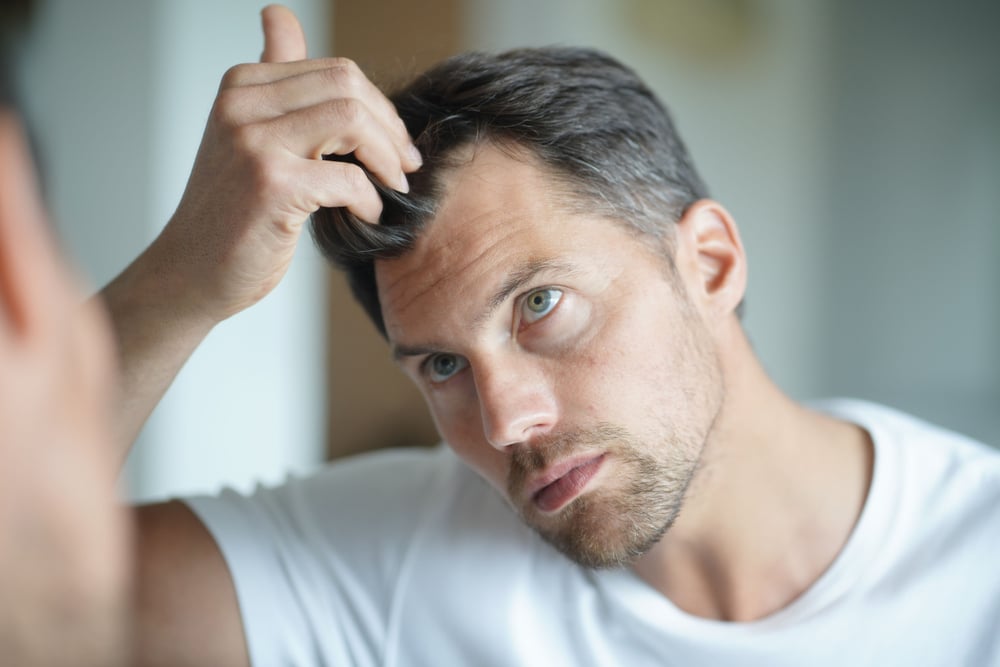 Understanding the Impact of Hair Loss on Self-Esteem