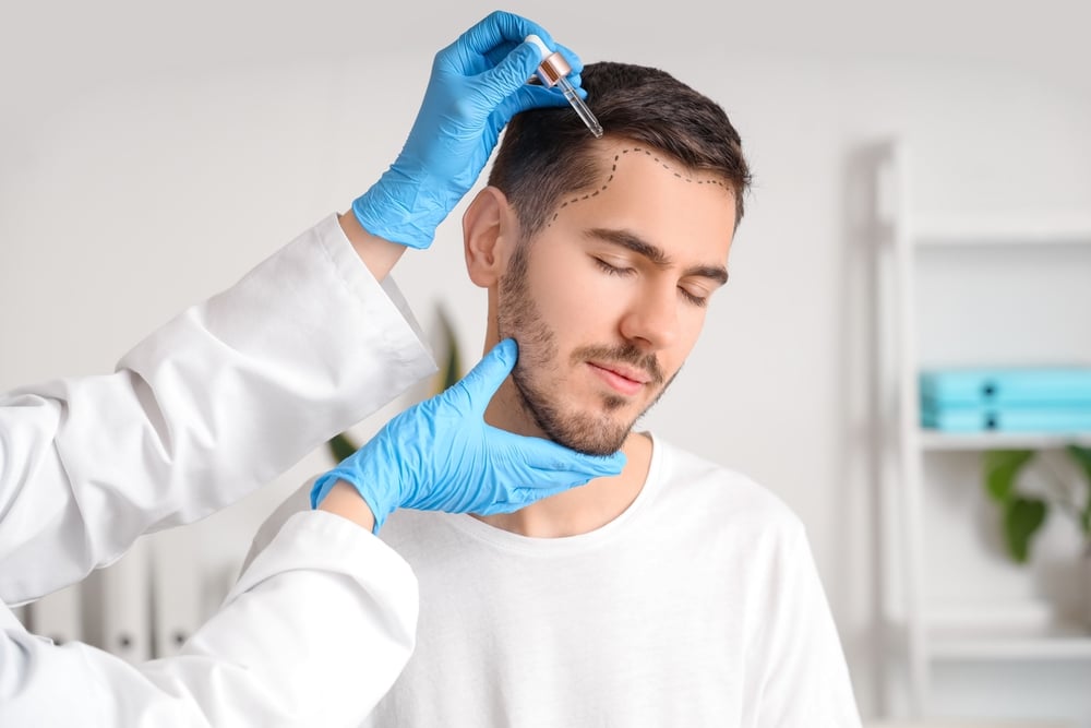 The Evolution of Hair Transplant Technology