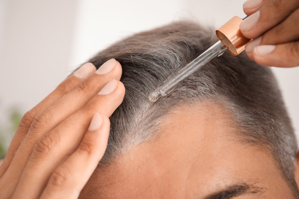 How to Manage Hair Loss in Children