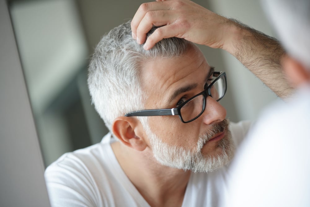 The Role of Genetics in Hair Loss